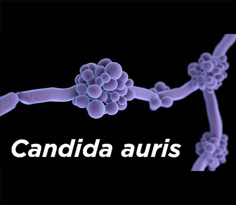 Candida auris A Serious Global Threat Surfacide UVC Disinfection